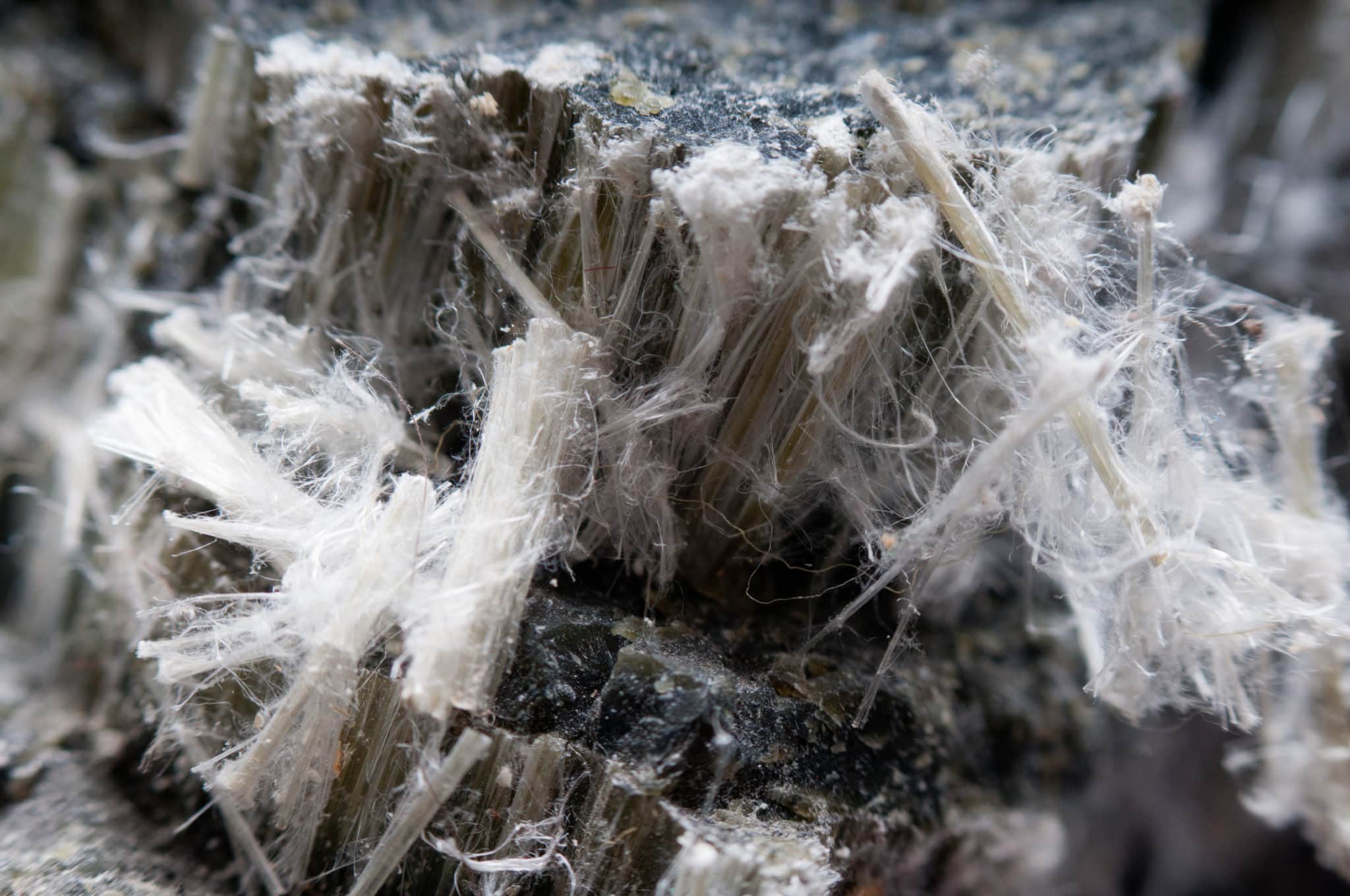 Asbestos mesothelioma